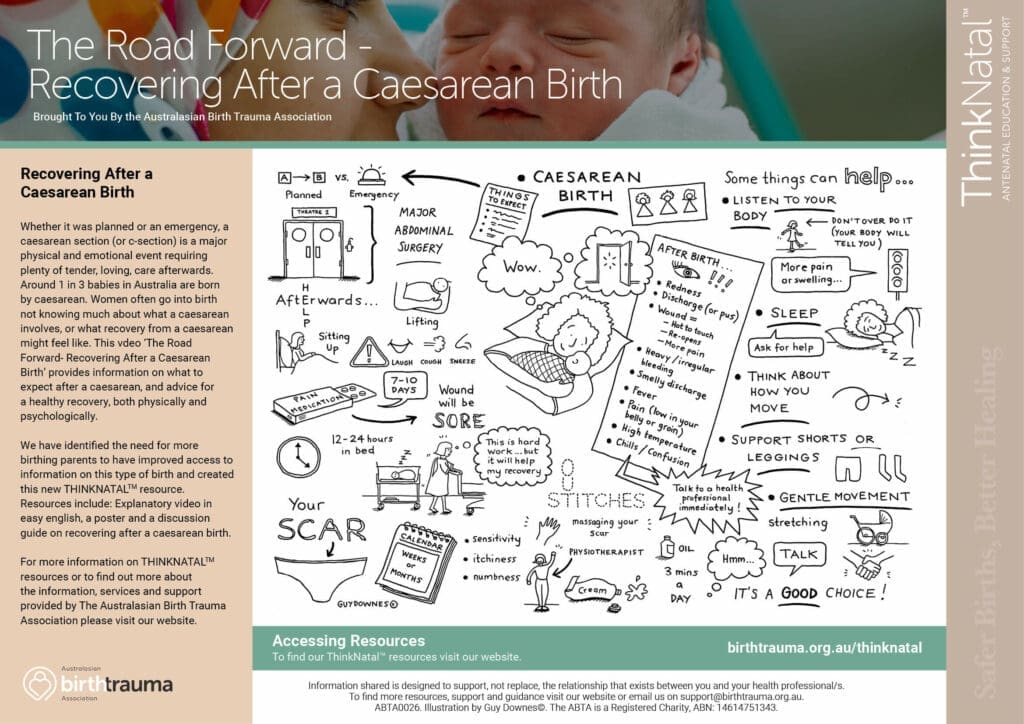 Thinknatal recovery after c-section